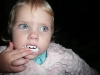 Vampire teeth.